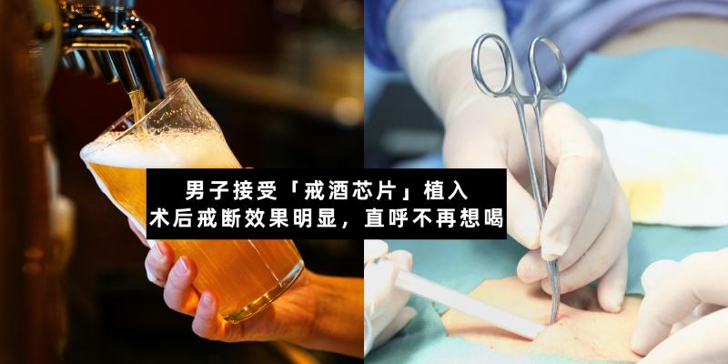 【新闻】以后喝酒不再快乐!|【男子接受「戒酒芯片」植入】术后戒断效果明显,直呼不再想喝。